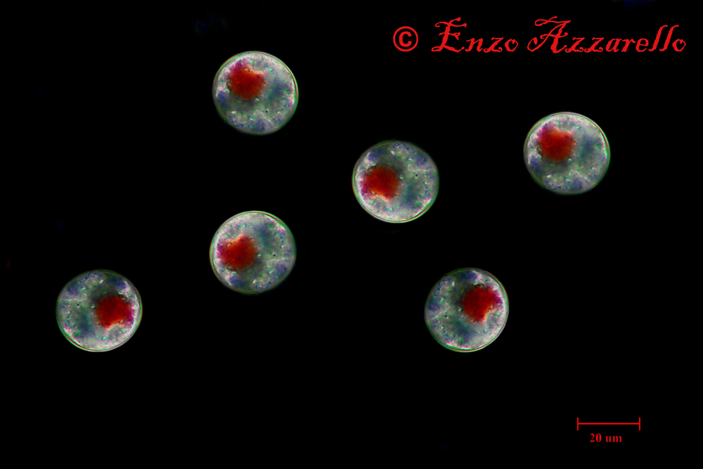 Haematococcus pluvialis stadio palmelloide - campo scuro